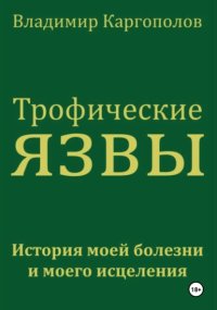 Трофические язвы. История моей болезни и моего исцеления